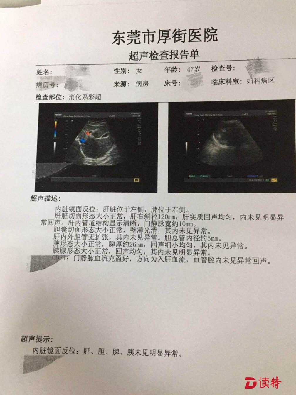 却发现子宫右侧附件有囊实性包块,医生考虑为卵巢癌肿瘤,随后入院治疗